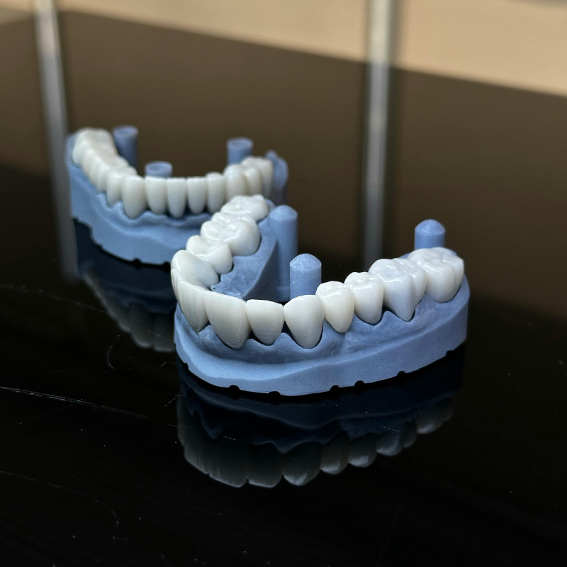 Invisalign clear aligners at BeauDent