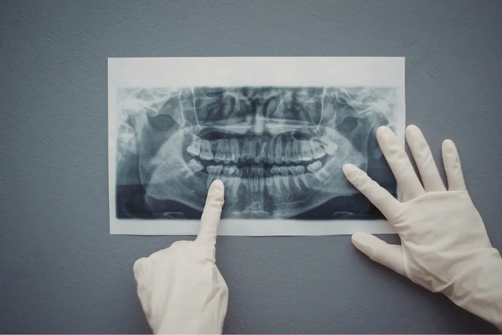 A dentist and assistant reviewing a digital dental x-ray